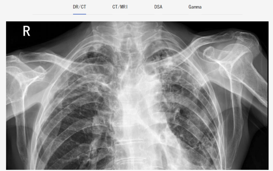 医疗影像诊断 医疗影像诊断
