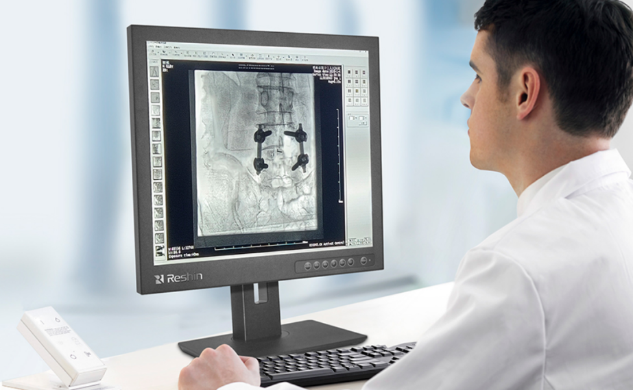 医疗影像软件PACS厂商 医疗影像软件PACS厂商