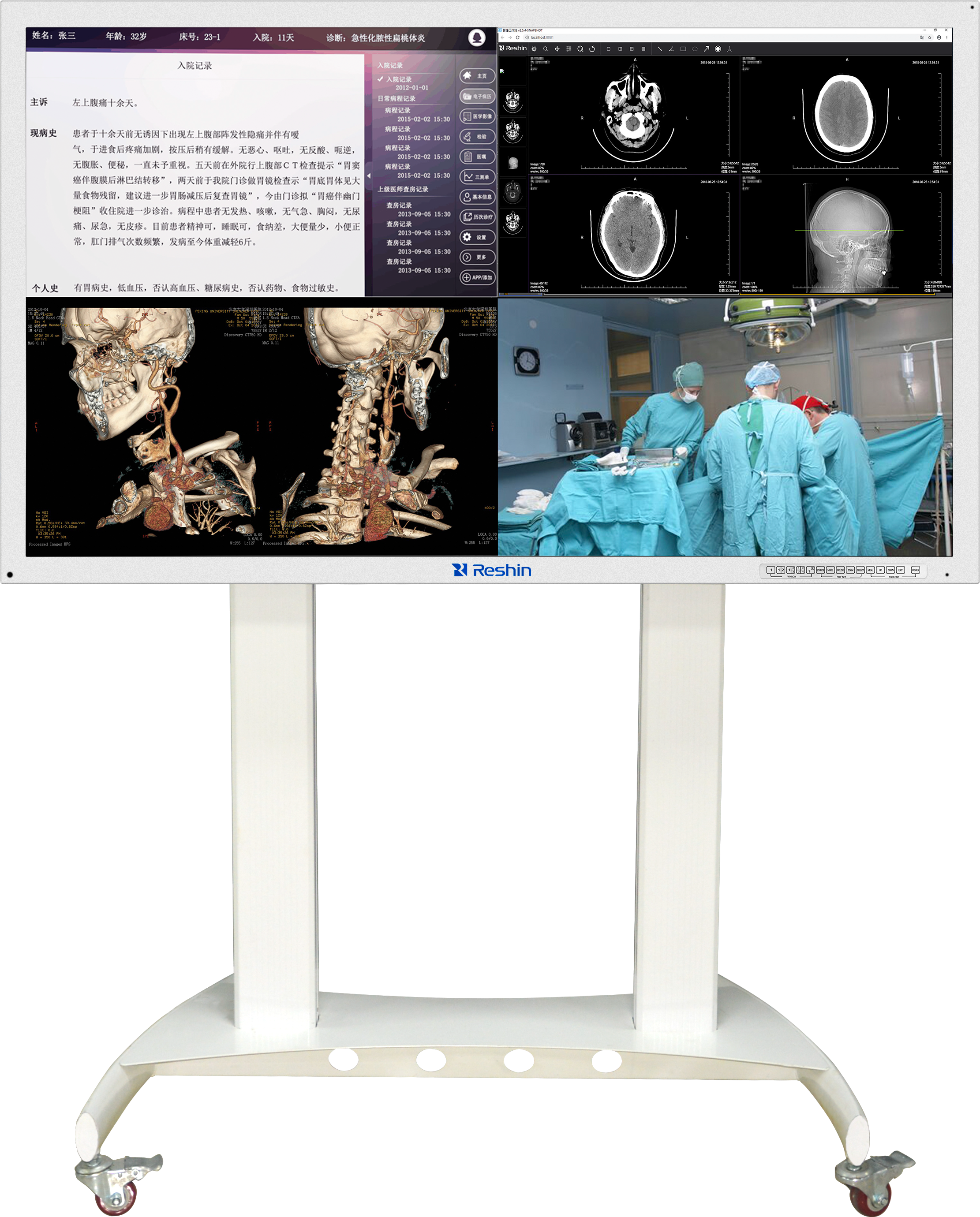 医用大屏显示器