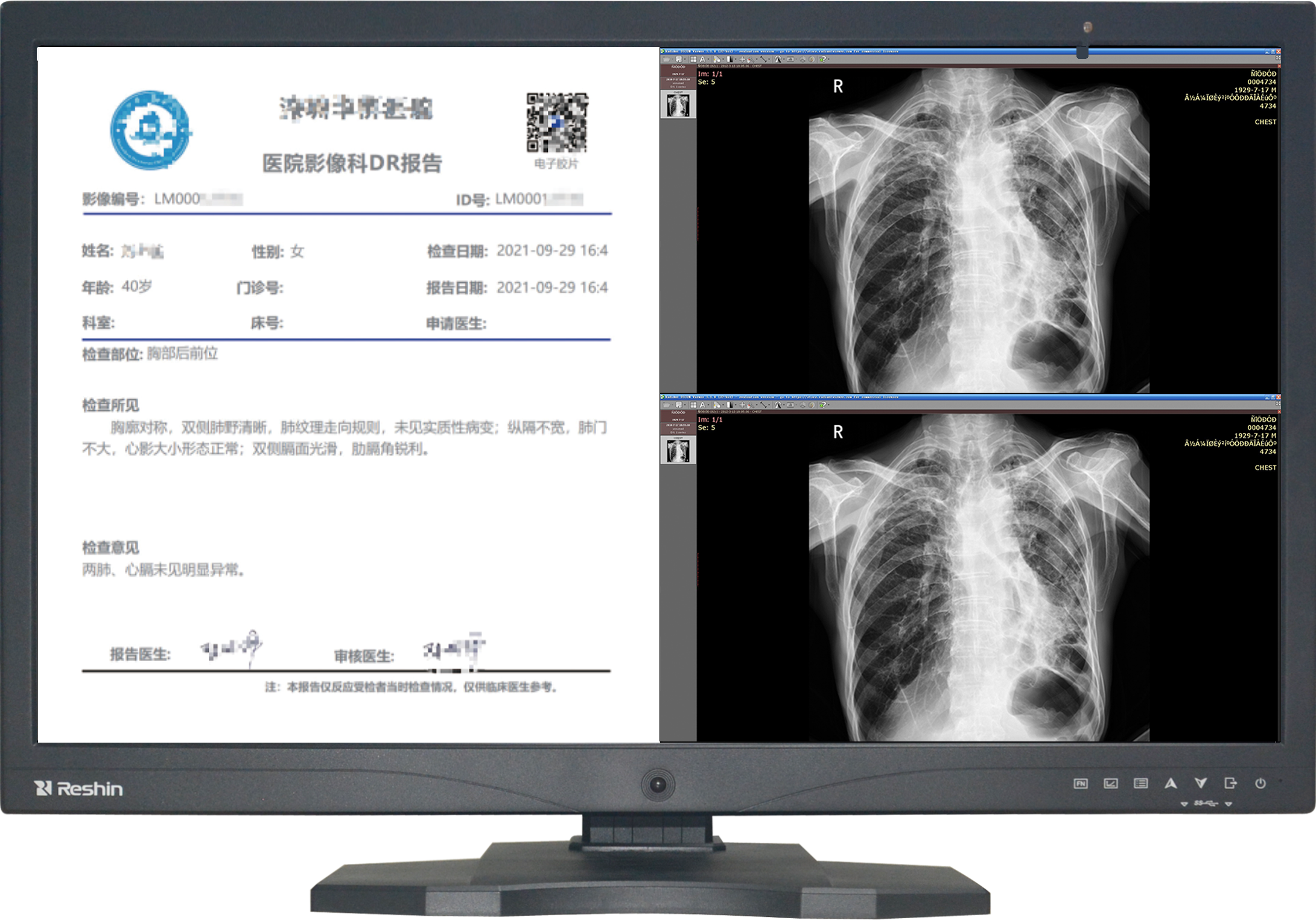 医疗显示器