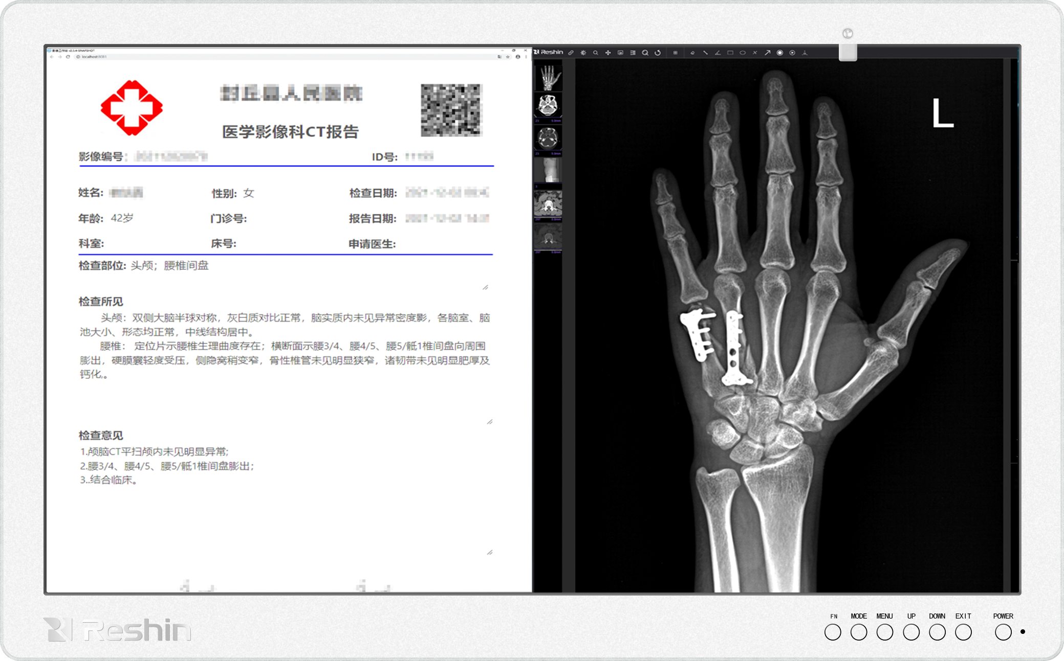 医用专业显示器